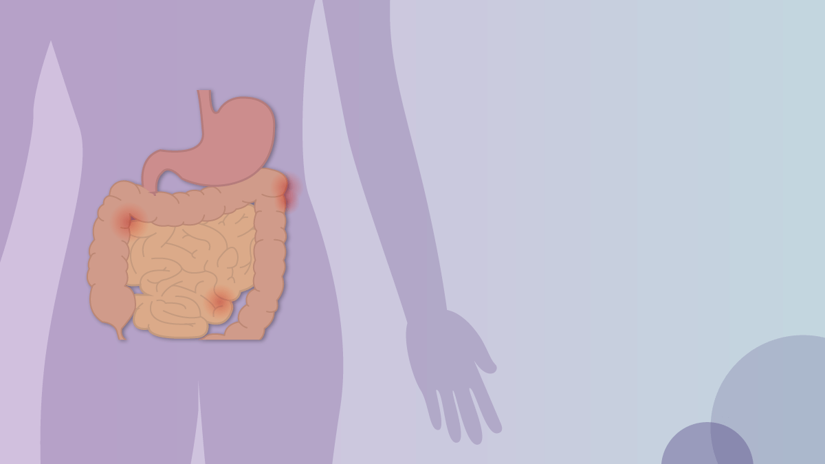 vivir-con-eii-enfermedad-inflamatoria-intestinal-crohn-colitis-titulo